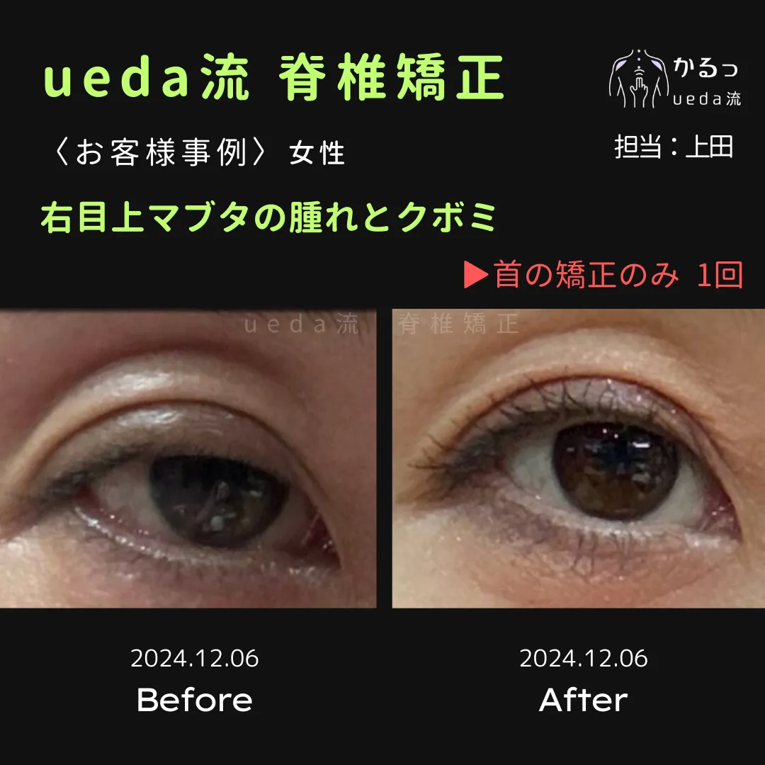 右目・マブタに注目！｜整体｜高砂市｜播州エリア