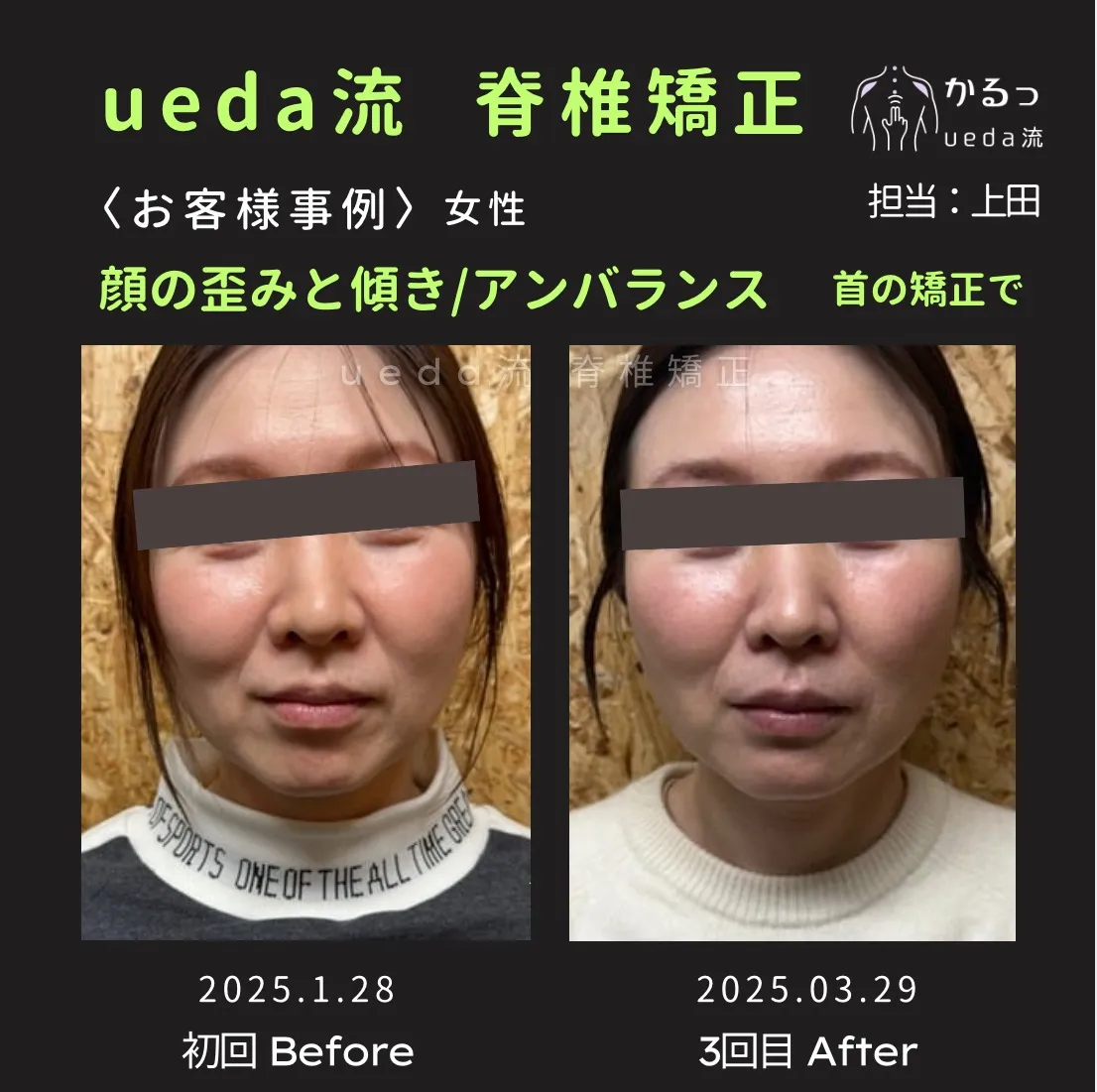 顔全体のバランスに注目！お肌の透明感まで✨｜整体｜高砂市｜播州エリア