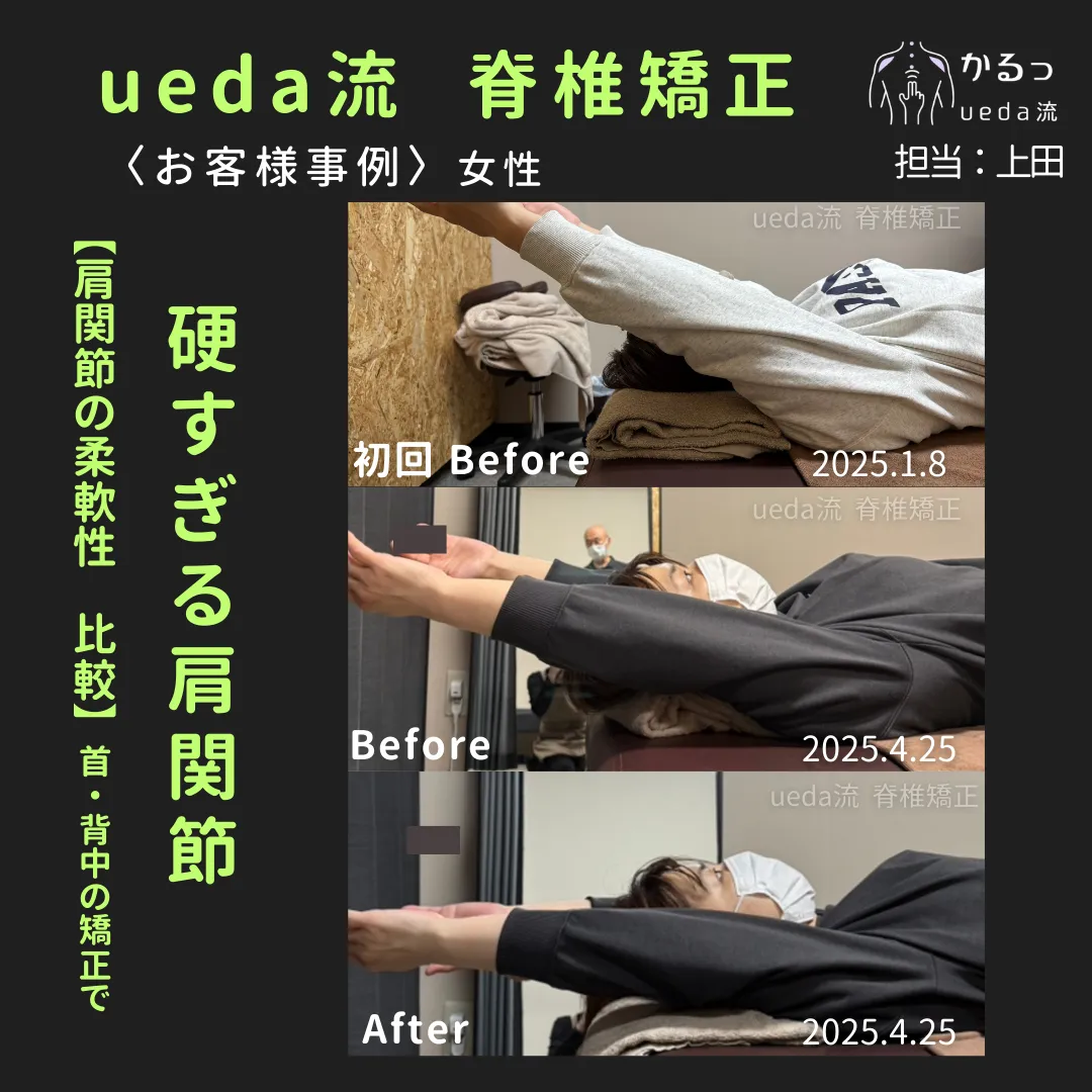 肩の柔軟性に注目！｜整体｜高砂市｜播州エリア