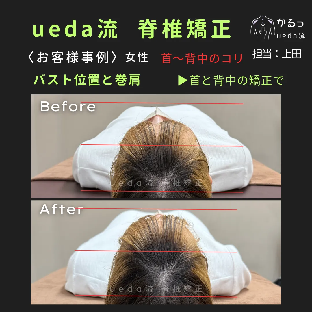 首と背中の矯正でバストラインが整う？｜整体｜高砂｜播州エリア