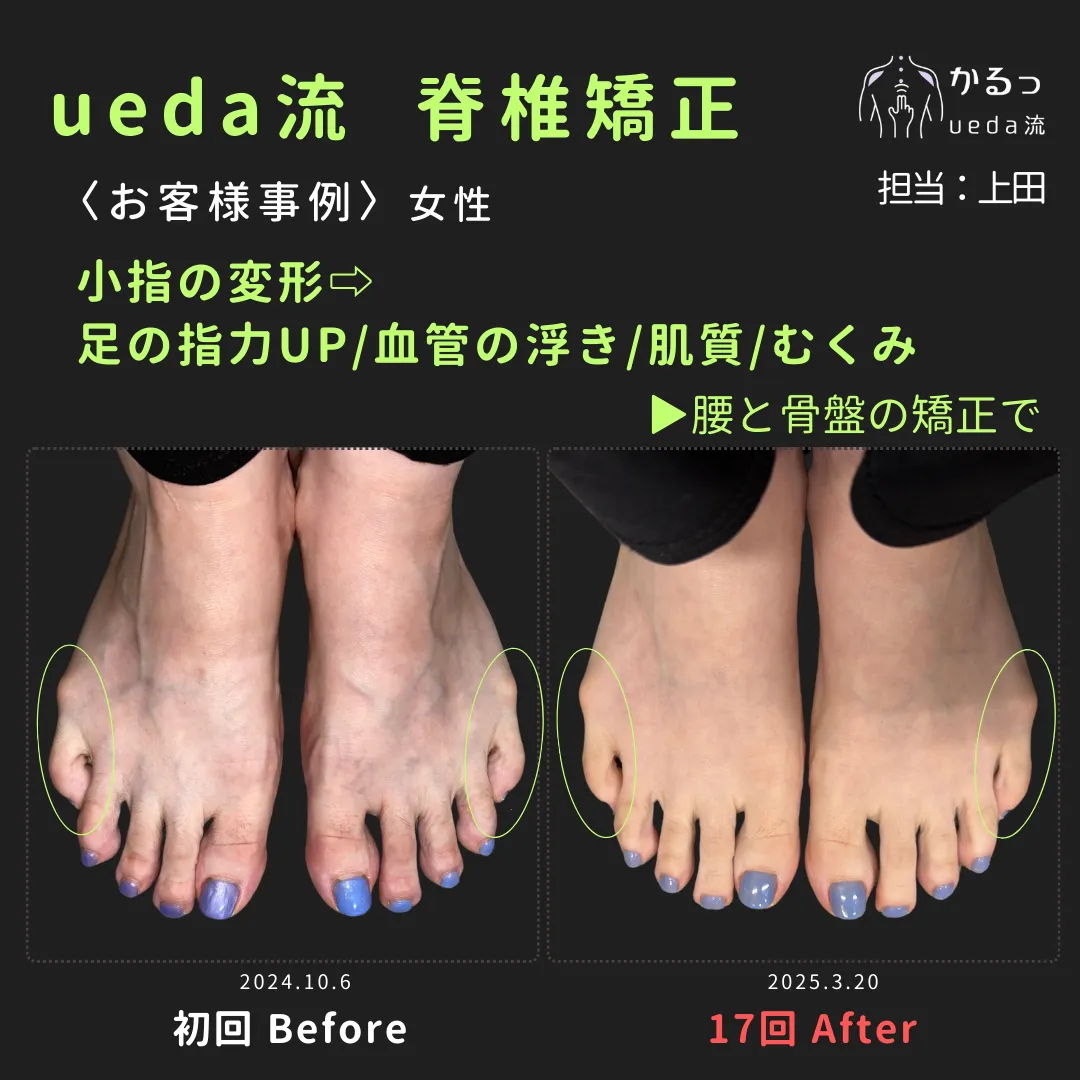 腰と骨盤の矯正で足指や皮膚の質感に変化が？｜整体｜高砂市