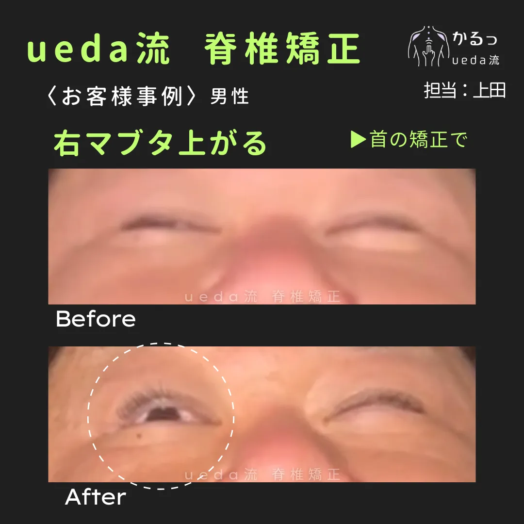 あなたは出来る？『ウインク』｜整体｜高砂市