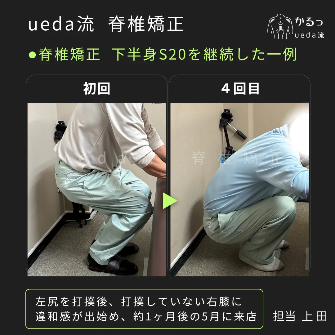 打撲していない右膝が痛くなったのはなぜ？｜整体｜高砂市
