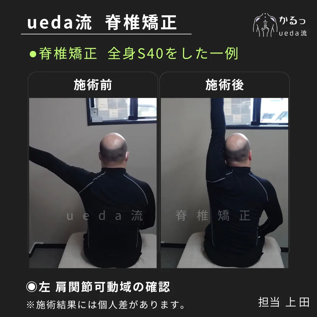 肩関節の動きをチェック！１９分後の変化は？｜整体｜高砂・加古川・姫路
