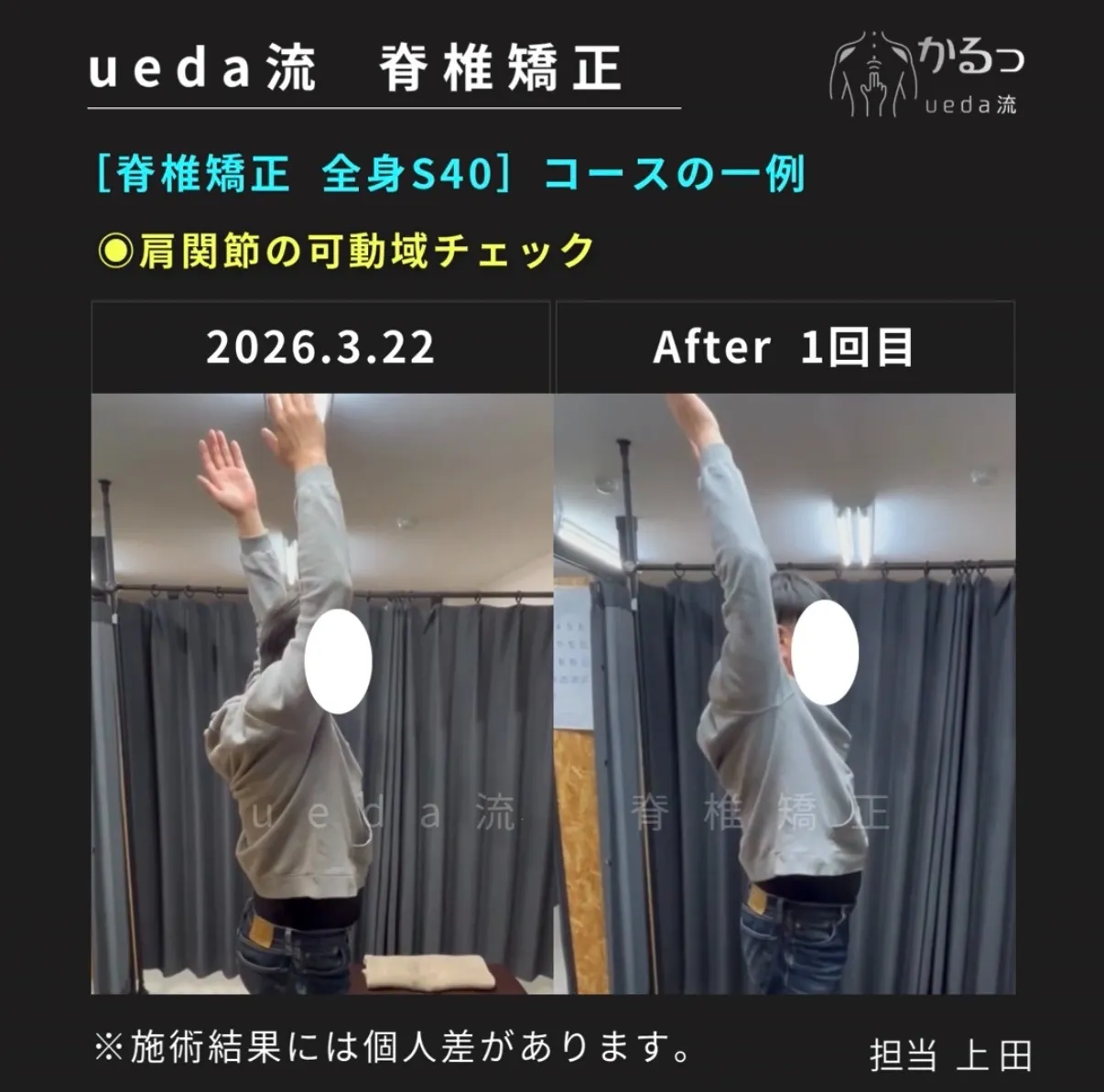 ５０肩なの？動かすと痛い右肩と肩関節の動きをチェック｜整体｜高砂・加古川・姫路