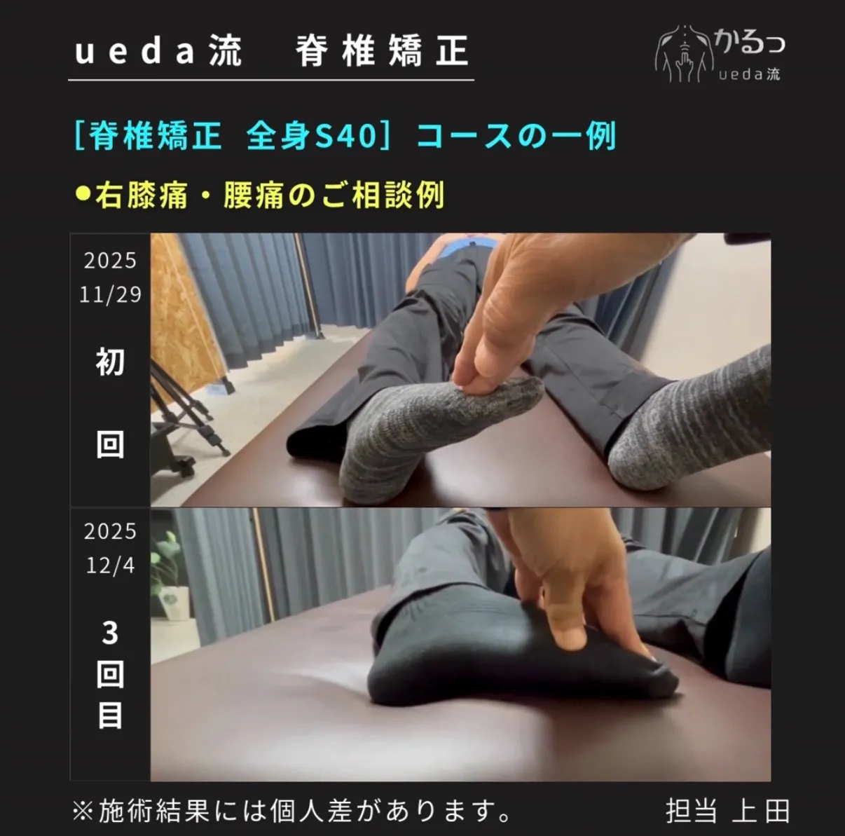 右膝と腰の痛みと股関節まわりのシビレ・・・。足首の可動域も関係する?|整体|高砂市